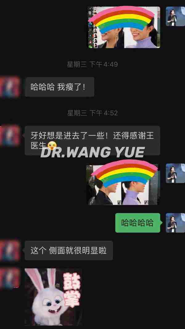 上海舌侧牙齿矫正｜拯救“整齐的龅牙”的利器